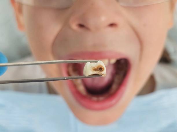 Best Cracked Tooth Emergency Dentist  in New Wilmington, PA